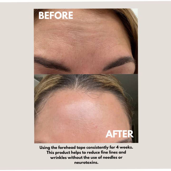 Seald Forehead Tape